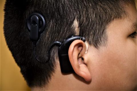 A child with a cochlear implant